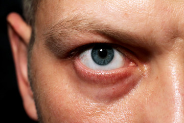 Human blue eye.