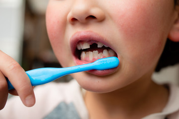 歯磨きをする前歯が抜けた子供