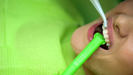 Female patient at dentist chair, procedure of bleaching teeth, modern clinic