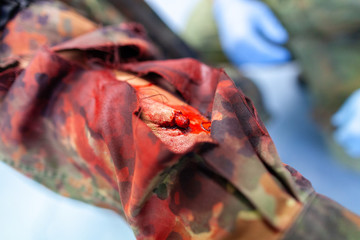 Paramedic soldier medicates a make up fracture