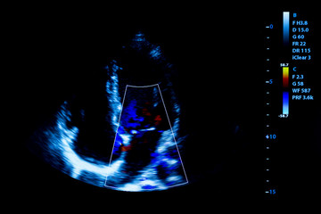 Colourful image of homan heart ultrasound monitor