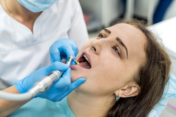 Fototapeta premium Dentist polishing patient's teeth after whitening procedure