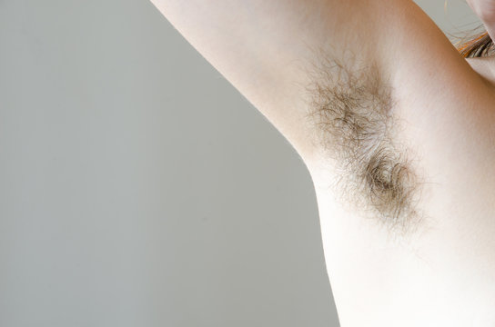 Hairy Woman's Armpit, Close-up, Unshaven, A Lot Of Hair On The Armpit