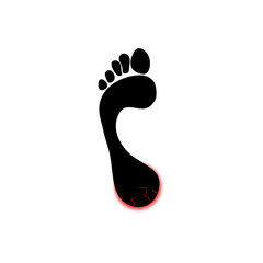 Symbol of Human foot with painful red cracks on heel. Vector object isolated on white background.