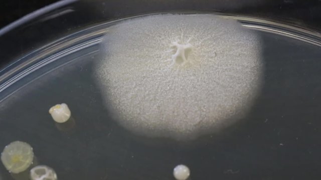 Different shaped colonies of bacteria, yeast and mold growing on agar plates from environmental samples.