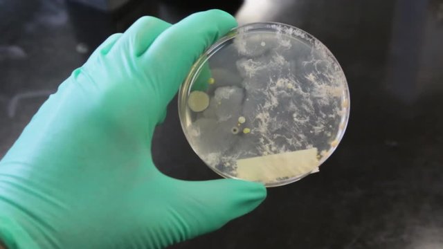 Different shaped colonies of bacteria, yeast and mold growing on agar plates from environmental samples.