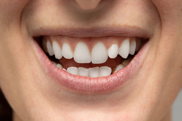 Closeup of a smiling woman's mouth