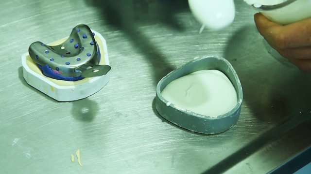 The dentist makes a dental implant made of silicone and gypsum. Dental prosthetics