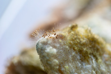 Rhizopus (bread mold) is a genus of common saprophytic fungi,Rhizopus (bread mold) under the microscope.