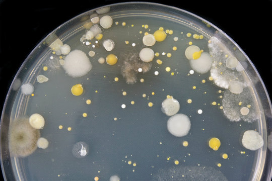 Close-up of bacteria and mold growing in a Petri dish.  Microorganisms were isolated from a computer keyboard by wiping the keyboard with a cotton swab and then inoculating the agar in the Petri dish