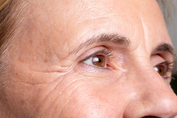 Closeup shot of elderly woman's forehead