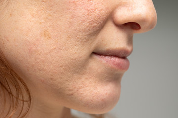 Lower half of woman's face, sideview