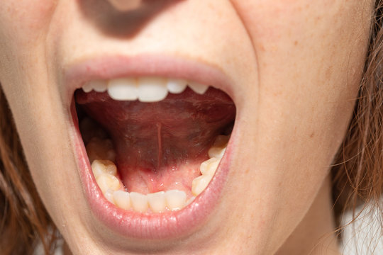 Closeup of woman's open mouth