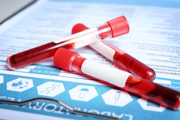Sample tubes with blood on laboratory test form, closeup. Research and analysis