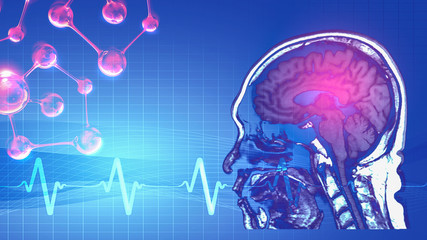 abstract background of magnetic resonance image (MRI) of brain with abstract symbol of pulse and...