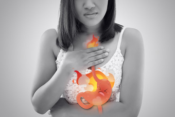 The Photo Of Cartoon Stomach On Woman's Body Against White Background, Acid Reflux Disease Symptoms...