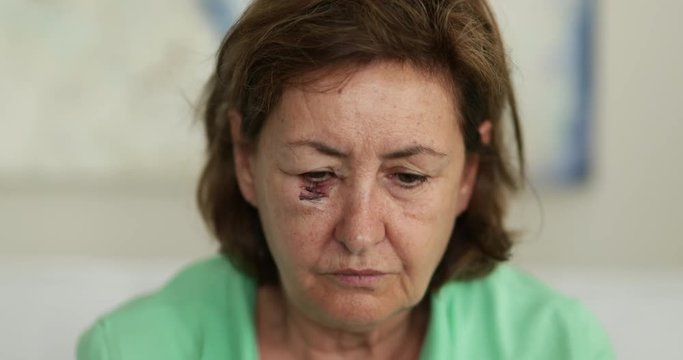 Bruised older woman with scar looking to camera with sad emotion