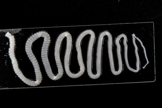 The study of Tapeworm infection is caused by ingesting food or water contaminated with tapeworm eggs or larvae in laboratory.