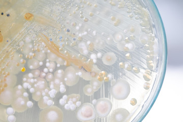 Colony characteristic of Actinomyces, Bacteria, yeast and Mold on selective media from soil samples...