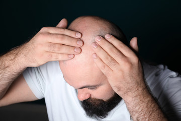 Fototapeta premium Man with hair loss problem on dark background