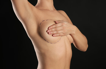 Young woman with marks on breast for cosmetic surgery operation against dark background