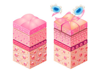 洗浄効果が強すぎる洗浄剤のイメージ