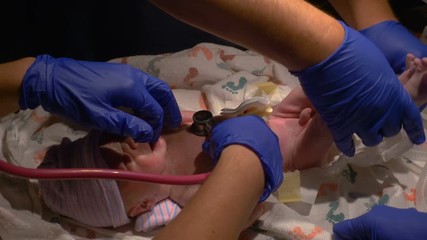 Newborn Premature Baby Check Up by Doctors