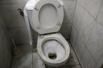Toilet dirty unhygienic