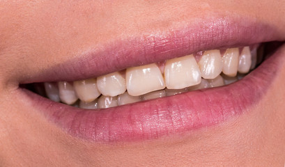 Woman smile with great natural teeth