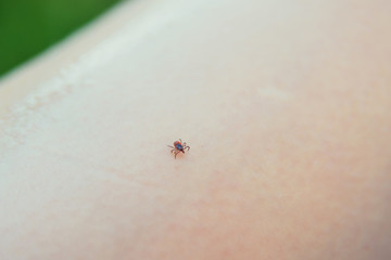 Fototapeta na wymiar Tick crawling on the skin. The concept of danger of encephalitis and tick bite.