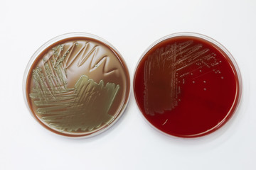 Bacteria in culture media
