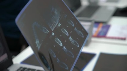 Medical student doctor holding X-ray film of teeth and jaw. Medicine university