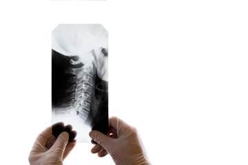 Close-up. Hands of a doctor in white gloves are holding an X-ray of the cervical vertebrae. The theme for the day of the physician and radiologist. White background. Copy space. Isolated.