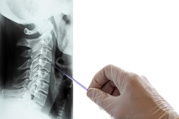 Closeup of the hand of a man in a white medical glove who holds a pointer and shows the spine on an X-ray. A picture of the cervical vertebrae. Day of radiologist. White background. Isolated Copyspace