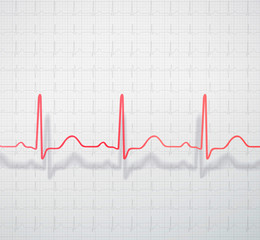 Dimensional ECG line with shadow on the graph paper