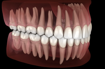 Morphology of mandibular and maxillary human gum and teeth. Medically accurate tooth 3D illustration