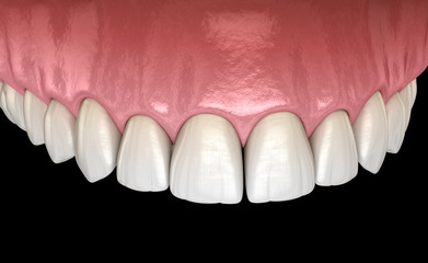 Maxillary human gum and teeth. Medically accurate tooth 3D illustration