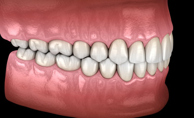 Healthy human teeth with normal occlusion, side view. Medically accurate tooth 3D illustration