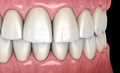 Healthy human teeth with normal occlusion, side view. Medically accurate tooth 3D illustration