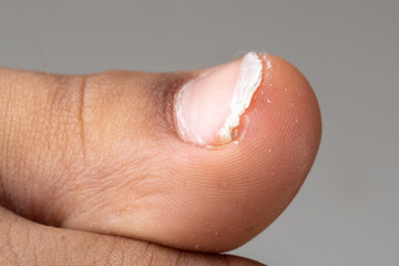 Closeup of kid toenails