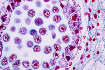 Lily Anther Sporogenous under the microscopic for education in laboratory.