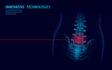 Laser physiotherapy human spine. Pain area surgery operation modern medicine technology low poly triangles 3D render female back hernia vector illustration