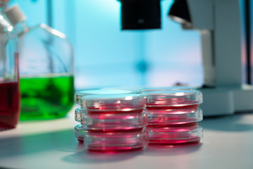 Petri dishes and microscope in medical lab case study of plastic pollution of natural water bodies