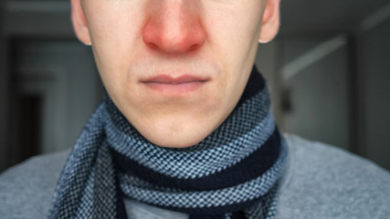 Unrecognizable sick guy in warm scarf with a red nose - obrazy, fototapety, plakaty