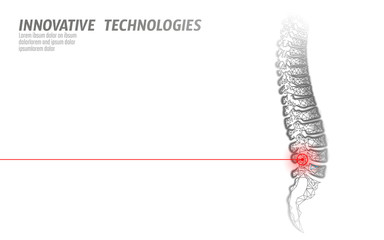 Laser physiotherapy human spine injury. Pain area surgery operation modern loin medicine technology low poly triangles 3D render female back hernia vector illustration