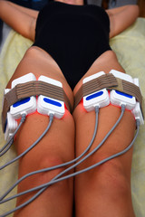 lipo laser. Hardware cosmetology. Body care. Non surgical body sculpting. body contouring...