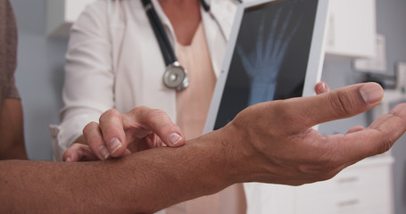 Close up of male patient hand and wrist with doctor explaining x ray on tablet. Tight view of senior doctor holding electronic pad with x-ray of patients wrist and hand