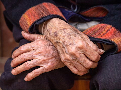 H&auml;nde einer alten Frau in Yunnan in China