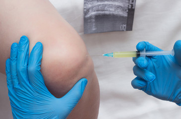 Doctor introduces blood plasma to a woman's knee joint to treat knee sutsawa, atrita, autoplasmotherapy, close-up