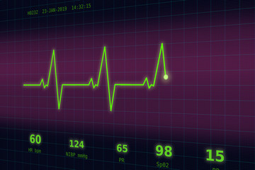 Graph of normal heartbeat on a violet - blue monitor